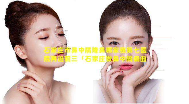 石家庄市鼻中隔隆鼻哪家强第七医院再进前三「石家庄做鼻中隔偏曲手术 🦁 哪个医院专业」